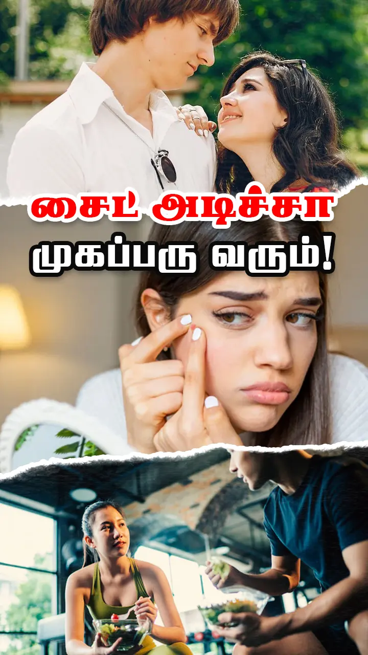 காதல் வந்தால் முகப்பரு வருமா?