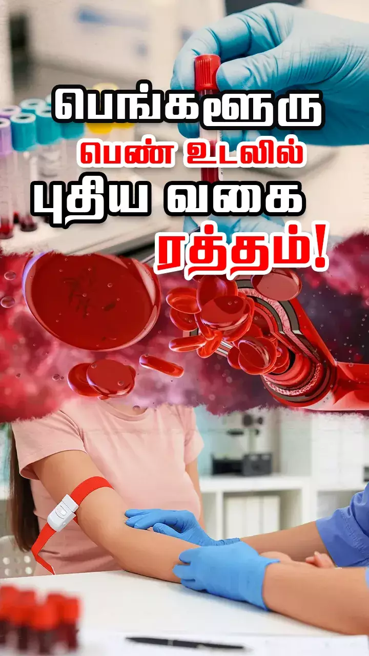 உலகில் இந்த பெண்ணுக்கு மட்டுமே உள்ளது! வேறு யாருக்கும் இல்லை!