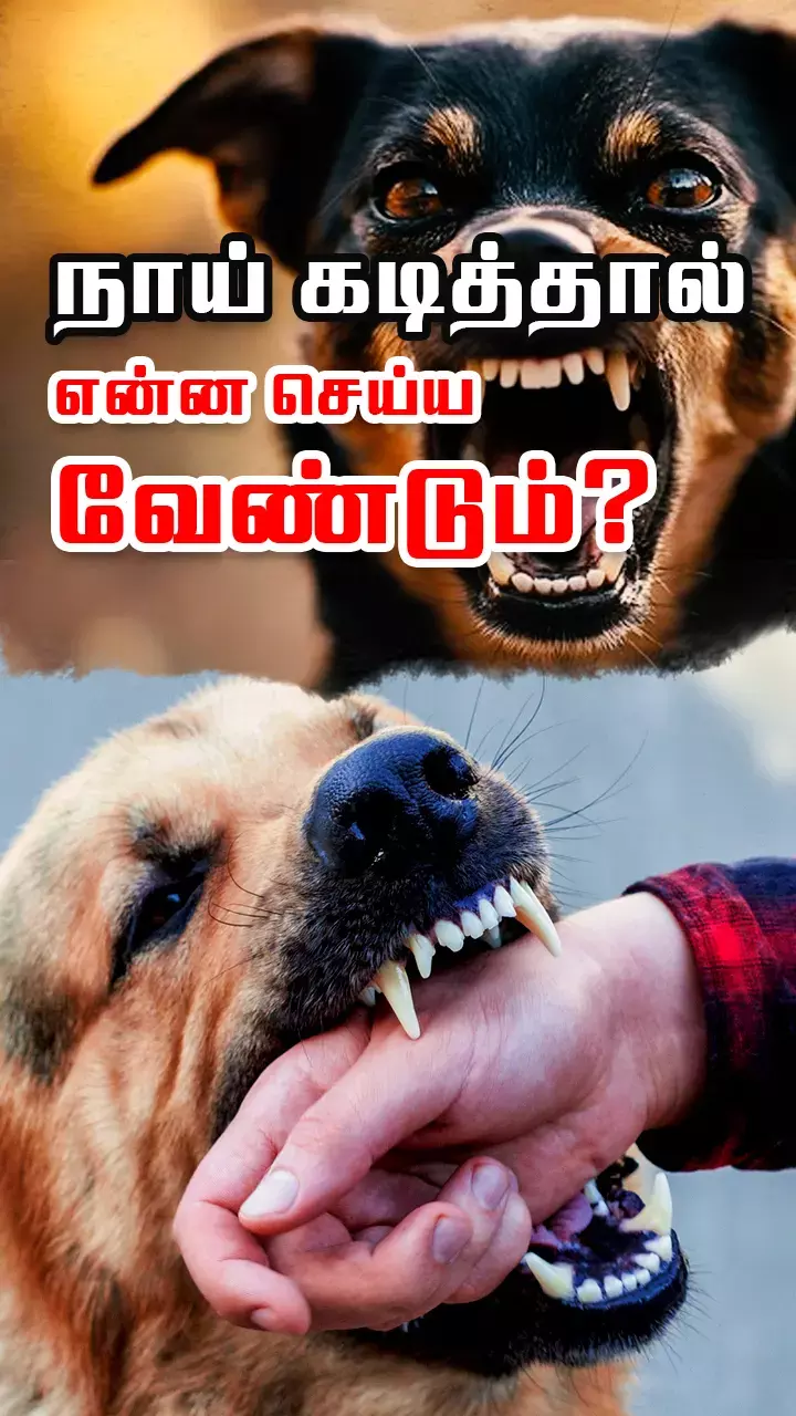 நாய் கடித்துவிட்டால் உடனடியாக செய்ய வேண்டியவை...