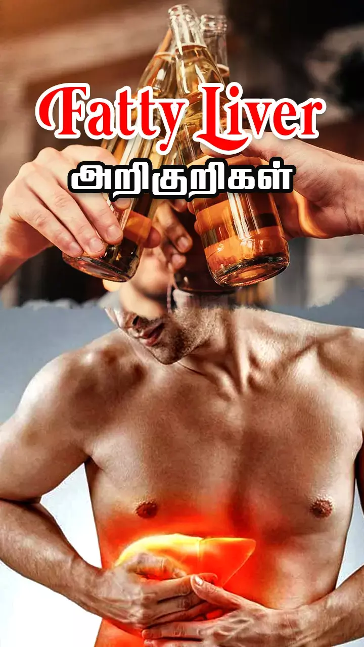 Fatty Liver-ஐ சரி செய்ய இயற்கை வழி
